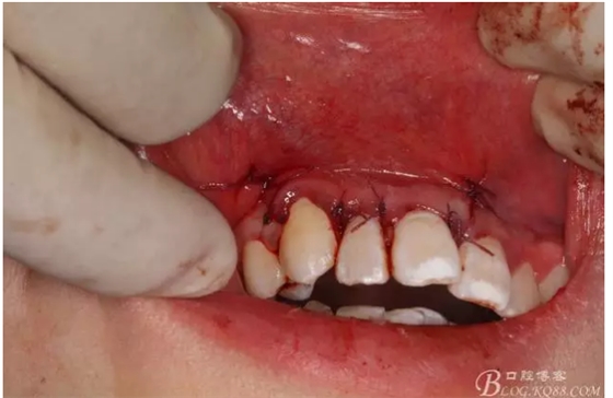 QQ圖片20150721155334.png QQ圖片20150721155334.png