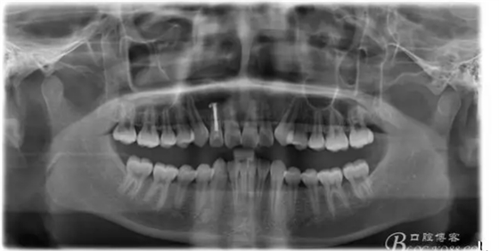 QQ圖片20150721155347.png QQ圖片20150721155347.png