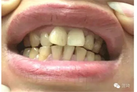 QQ圖片20150724134516.png QQ圖片20150724134516.png