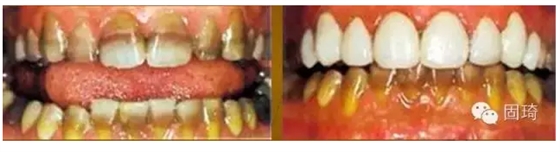 QQ圖片20150724134607.png QQ圖片20150724134607.png