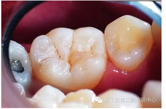 QQ圖片20150724142714.png QQ圖片20150724142714.png