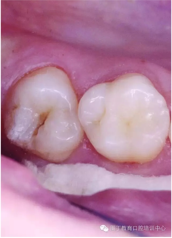 QQ圖片20150724142742.png QQ圖片20150724142742.png