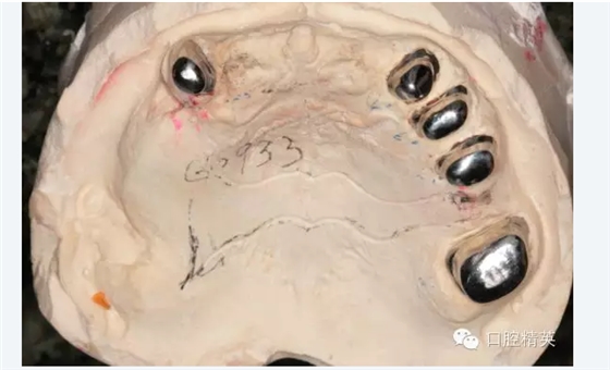 QQ圖片20150725092322.png QQ圖片20150725092322.png