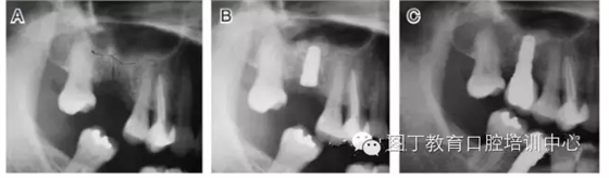 QQ圖片20150725105909.png QQ圖片20150725105909.png