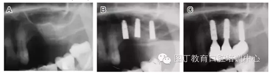 QQ圖片20150725105921.png QQ圖片20150725105921.png