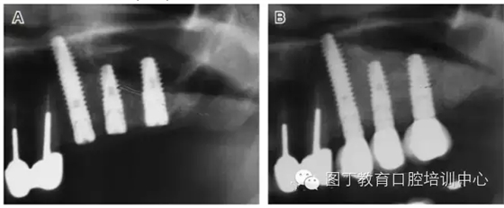 QQ圖片20150725105958.png QQ圖片20150725105958.png