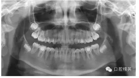 QQ圖片20150727085338.png QQ圖片20150727085338.png