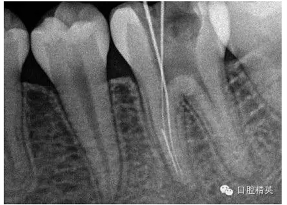 QQ圖片20150727085426.png QQ圖片20150727085426.png