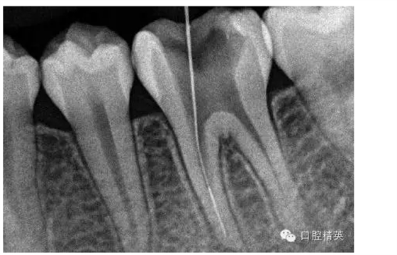 QQ圖片20150727085457.png QQ圖片20150727085457.png