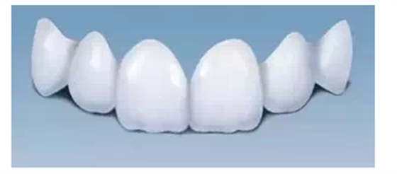 瓷貼面實戰(zhàn)流程 瓷貼面實戰(zhàn)流程