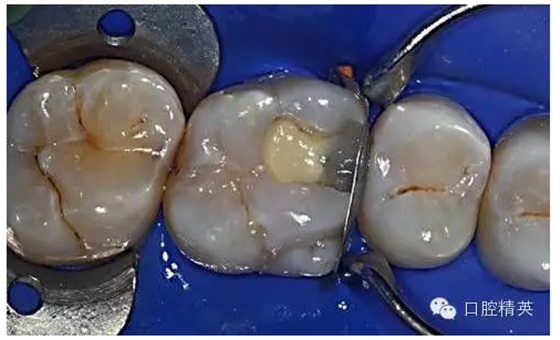 QQ圖片20150727134845.png QQ圖片20150727134845.png