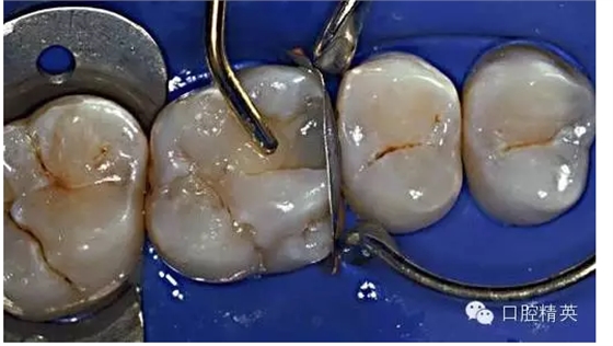 QQ圖片20150727134923.png QQ圖片20150727134923.png