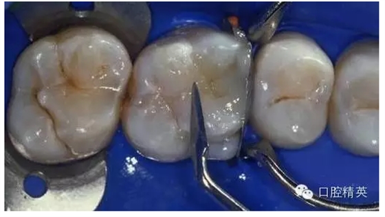 QQ圖片20150727134948.png QQ圖片20150727134948.png