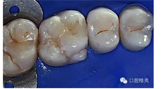 QQ圖片20150727135033.png QQ圖片20150727135033.png