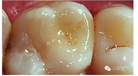 QQ圖片20150727135103.png QQ圖片20150727135103.png