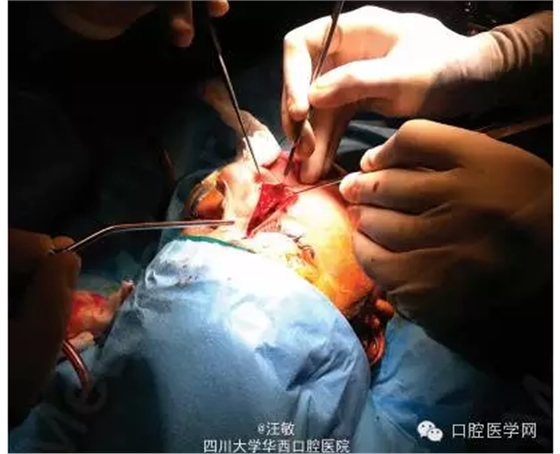 QQ圖片20150727142240.png QQ圖片20150727142240.png