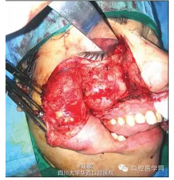 QQ圖片20150727142252.png QQ圖片20150727142252.png