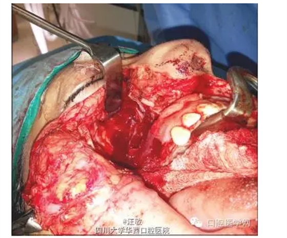 QQ圖片20150727142303.png QQ圖片20150727142303.png