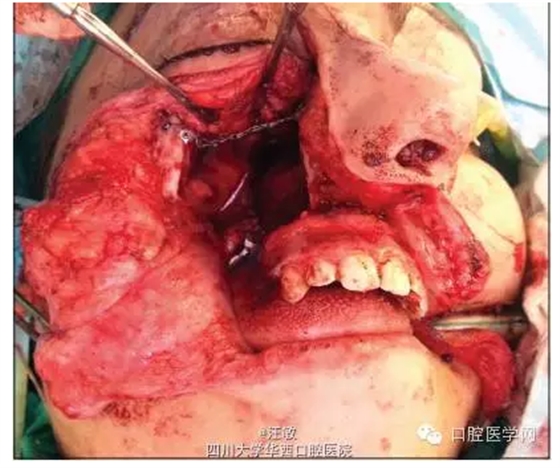 QQ圖片20150727142331.png QQ圖片20150727142331.png