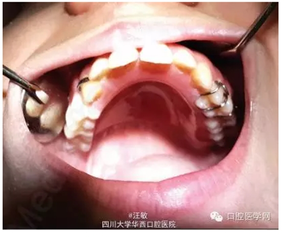 QQ圖片20150727142511.png QQ圖片20150727142511.png