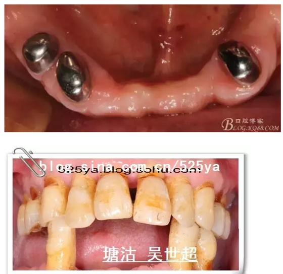 QQ圖片20150728084620.png QQ圖片20150728084620.png