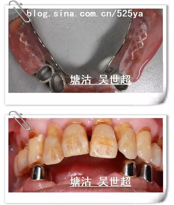 QQ圖片20150728084700.png QQ圖片20150728084700.png