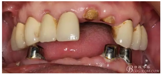 QQ圖片20150728084757.png QQ圖片20150728084757.png