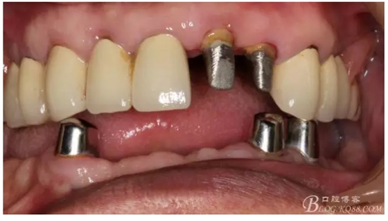 QQ圖片20150728084831.png QQ圖片20150728084831.png