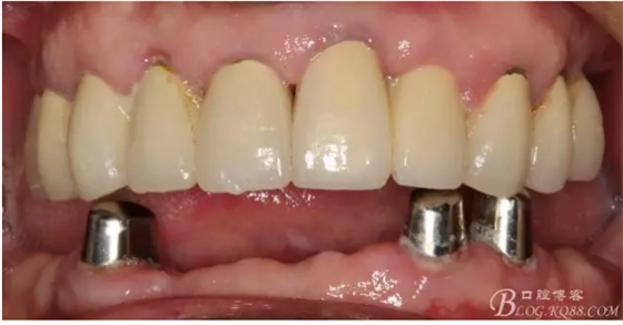 QQ圖片20150728084844.png QQ圖片20150728084844.png