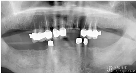 QQ圖片20150728084859.png QQ圖片20150728084859.png