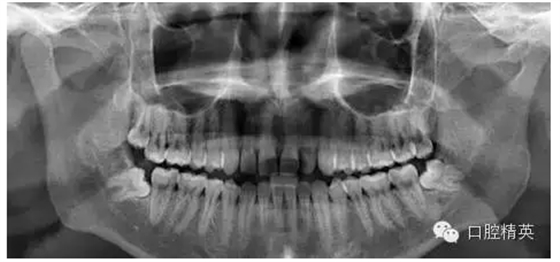 QQ圖片20150728093418.png QQ圖片20150728093418.png