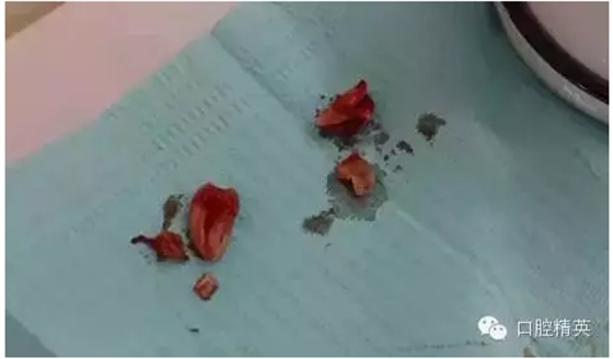 QQ圖片20150728093454.png QQ圖片20150728093454.png