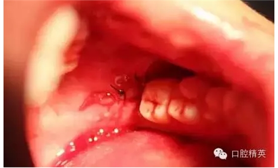 QQ圖片20150728093518.png QQ圖片20150728093518.png