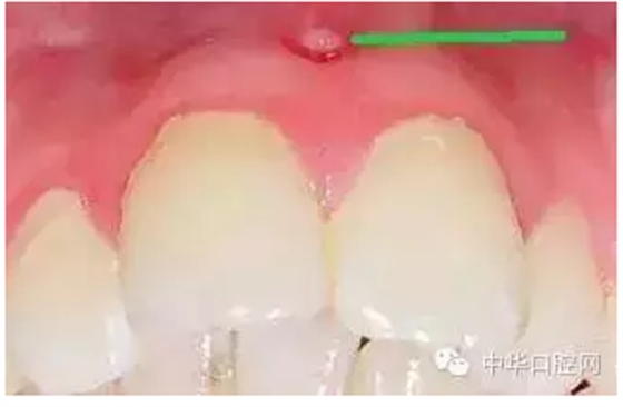 QQ圖片20150728142620.png QQ圖片20150728142620.png