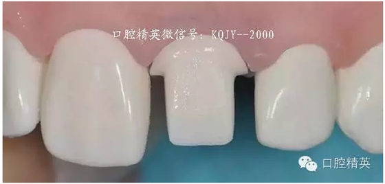 為什么你的牙齒備不好 為什么你的牙齒備不好