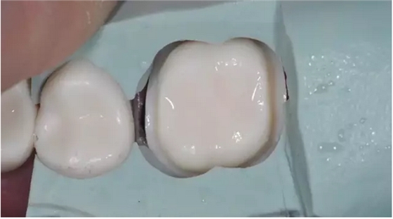 為什么你的牙齒備不好 為什么你的牙齒備不好