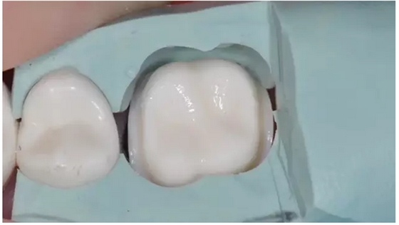 為什么你的牙齒備不好 為什么你的牙齒備不好