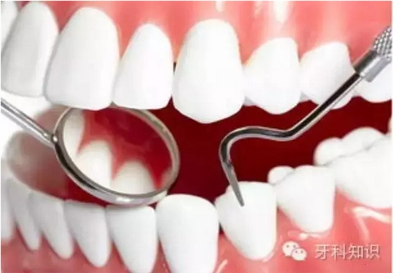 補(bǔ)牙全過程 補(bǔ)牙全過程