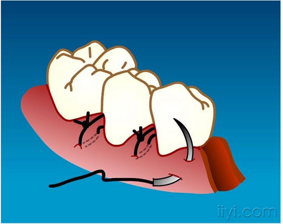 QQ圖片20150729104242.png QQ圖片20150729104242.png