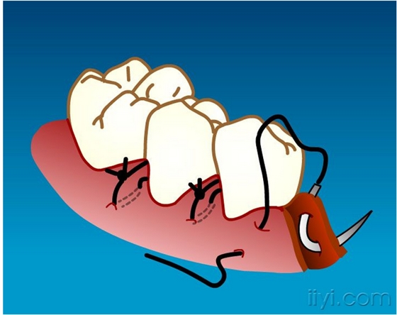 QQ圖片20150729104254.png QQ圖片20150729104254.png