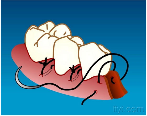 QQ圖片20150729104305.png QQ圖片20150729104305.png