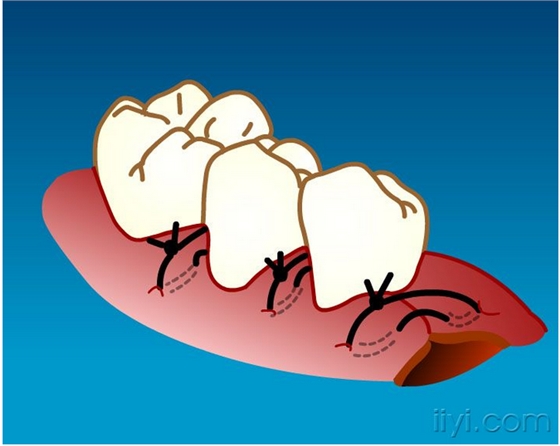 QQ圖片20150729104317.png QQ圖片20150729104317.png