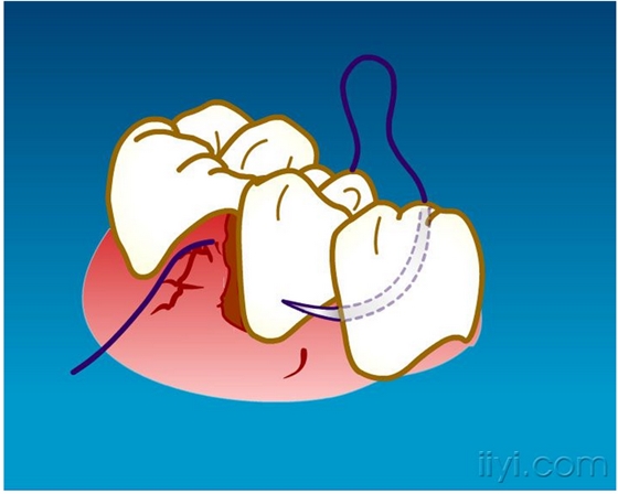 QQ圖片20150729104537.png QQ圖片20150729104537.png