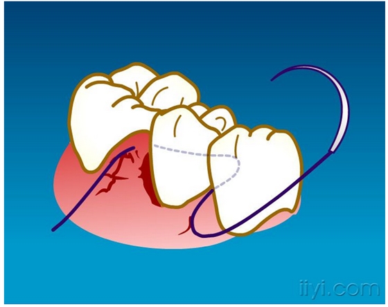 QQ圖片20150729104549.png QQ圖片20150729104549.png