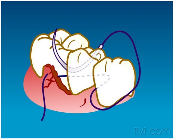 QQ圖片20150729104602.png QQ圖片20150729104602.png