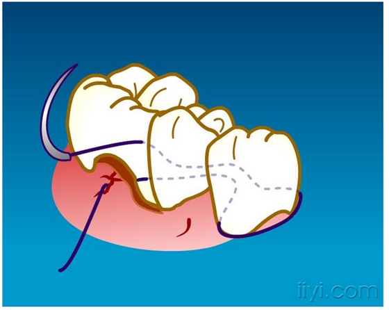 QQ圖片20150729104613.png QQ圖片20150729104613.png