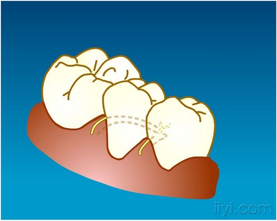 QQ圖片20150729104625.png QQ圖片20150729104625.png