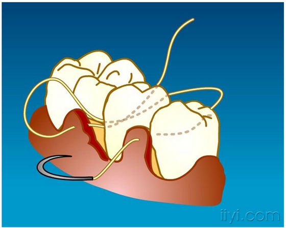 QQ圖片20150729104820.png QQ圖片20150729104820.png