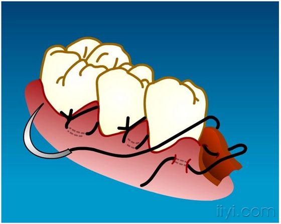 QQ圖片20150729104917.png QQ圖片20150729104917.png