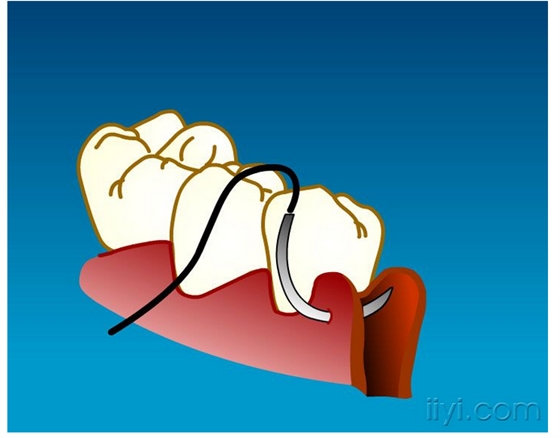 QQ圖片20150729104942.png QQ圖片20150729104942.png